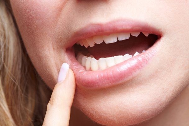 Câncer de boca: o papel fundamental do cirurgião-dentista